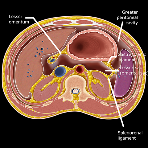 peritoneal-endometriosis-new-york-gynecology-endometriosis